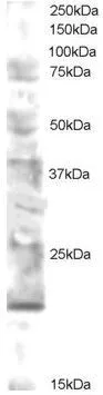 WB analysis of human brain lysate using GTX89925 MMS2 antibody, N-term. Dilution : 0.5microg/ml Loading : 30microg protein in RIPA buffer WB analysis of human brain lysate using GTX89925 MMS2 antibody, N-term. Dilution : 0.5microg/ml Loading : 30microg protein in RIPA buffer