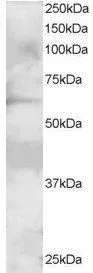 WB analysis of A431 lysate using GTX89926 GRB7 antibody, N-term. Dilution : 2microg/ml Loading : 30microg protein in RIPA buffer WB analysis of A431 lysate using GTX89926 GRB7 antibody, N-term. Dilution : 2microg/ml Loading : 30microg protein in RIPA buffer