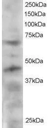 WB analysis of HeLa lysate using GTX89932 TRF1 antibody, C-term. Dilution : 2microg/ml Loading : 30microg protein in RIPA buffer WB analysis of HeLa lysate using GTX89932 TRF1 antibody, C-term. Dilution : 2microg/ml Loading : 30microg protein in RIPA buffer