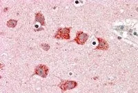 IHC-P analysis of human cortex using GTX89935 DKK3 antibody, C-term. Antigen retrieval : citrate buffer pH 6 Dilution : 5microg/ml