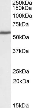 WB analysis of A431 lysate using GTX89936 PRPF31 antibody, C-term. Dilution : 0.3microg/ml Loading : 35microg protein in RIPA buffer WB analysis of A431 lysate using GTX89936 PRPF31 antibody, C-term. Dilution : 0.3microg/ml Loading : 35microg protein in RIPA buffer