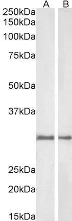 WB analysis of rat (A) and pig (B) kidney lysate using GTX89937 NQO1 antibody, C-term. Dilution : 1microg/ml Loading : 35microg protein in RIPA buffer WB analysis of rat (A) and pig (B) kidney lysate using GTX89937 NQO1 antibody, C-term. Dilution : 1microg/ml Loading : 35microg protein in RIPA buffer