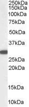 WB analysis of human kidney lysate using GTX89937 NQO1 antibody, C-term. Dilution : 0.03microg/ml Loading : 35microg protein in RIPA buffer