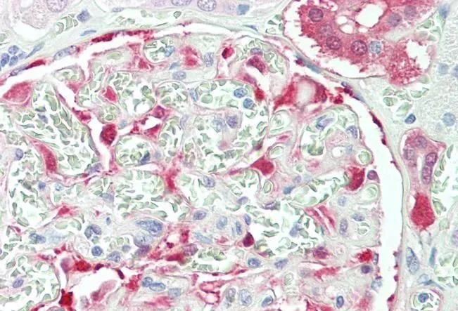 IHC-P analysis of human kidney using GTX89937 NQO1 antibody, C-term. Antigen retrieval : citrate buffer pH 6 Dilution : 5microg/ml