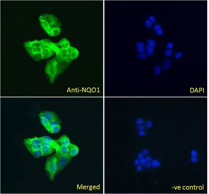 ICC/IF analysis of PFA fixed HepG2 cells using GTX89937 NQO1 antibody, C-term. Green : Primary antibody Blue : DAPI Negative control : Unimmunized goat IgG Permeabilization : 0.15% Triton Dilution : 5microg/ml