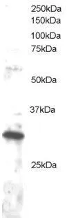 WB analysis of Jurkat lysate using GTX89941 DKK4 antibody, C-term. Dilution : 1microg/ml Loading : 30microg protein in RIPA buffer WB analysis of Jurkat lysate using GTX89941 DKK4 antibody, C-term. Dilution : 1microg/ml Loading : 30microg protein in RIPA buffer