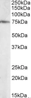 WB analysis of human brain (Hipoocampus) lysate using GTX89943 ELMO3 antibody, C-term. Dilution : 0.1microg/ml Loading : 35microg protein in RIPA buffer WB analysis of human brain (Hipoocampus) lysate using GTX89943 ELMO3 antibody, C-term. Dilution : 0.1microg/ml Loading : 35microg protein in RIPA buffer