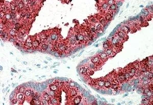 IHC-P analysis of human prostate using GTX89943 ELMO3 antibody, C-term. Antigen retrieval : citrate buffer pH 6 Dilution : 5microg/ml