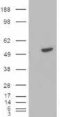 WB analysis of HEK293 overexpressing BLNK (mock transfection in first lane) using GTX89949 BLNK antibody, C-term.