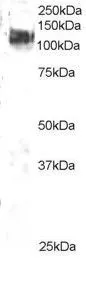 WB analysis of 3T3 lysate using GTX89954 CBL antibody, C-term. Dilution : 2microg/ml Loading : 35microg protein in RIPA buffer WB analysis of 3T3 lysate using GTX89954 CBL antibody, C-term. Dilution : 2microg/ml Loading : 35microg protein in RIPA buffer