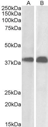 WB analysis of Daudi (A) and Molt-4 (B) cell lysate using GTX89960 SET antibody, N-term. Dilution : 0.01microg/ml Loading : 35microg protein in RIPA buffer