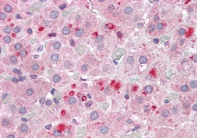 IHC-P analysis of human adrenal gland using GTX89960 SET antibody, N-term. Antigen retrieval : citrate buffer pH 6 Dilution : 3.75microg/ml IHC-P analysis of human adrenal gland using GTX89960 SET antibody, N-term. Antigen retrieval : citrate buffer pH 6 Dilution : 3.75microg/ml