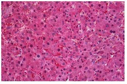 IHC-P analysis of human liver using GTX89964 SEC61A1 antibody, C-term. Antigen retrieval : citrate buffer pH 6 Dilution : 3.75microg/ml