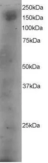 WB analysis of A431 lysate using GTX89965 DOCK1 antibody, C-term. Dilution : 4microg/ml Loading : 35microg protein in RIPA buffer WB analysis of A431 lysate using GTX89965 DOCK1 antibody, C-term. Dilution : 4microg/ml Loading : 35microg protein in RIPA buffer