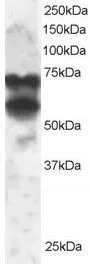 WB analysis of 293 lysate using GTX89966 PPP2R5D antibody,C-term. Dilution : 2ug/ml Loading : 30ug protein in RIPA buffer