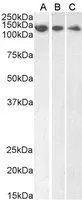 WB analysis of HeLa (A), HepG2 (B) and Jurkat (C) lysate using GTX89975 DDB1 antibody, C-term. Dilution : 1microg/ml Loading : 35microg protein in RIPA buffer