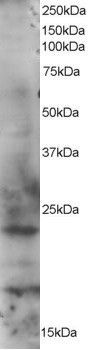 WB analysis of HeLa lysate using GTX89976 RAB2A antibody,C-term. Dilution : 1ug/ml Loading : 35ug protein in RIPA buffer