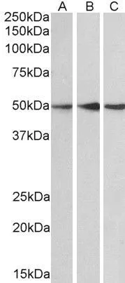 WB analysis of human cerebellum (A),mouse (B) and rat (C) brain lysate using GTX89983 PPP2R5E antibody,C-term. Dilution : 0.1ug/ml Loading : 35ug protein in RIPA buffer