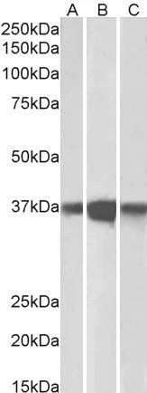 WB analysis of mouse (A), rat (B) and pig (C) brain lysates using GTX89984 PP2A alpha + PP2A beta antibody, C-term. Dilution : 0.1microg/ml Loading : 35microg protein in RIPA buffer