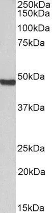 WB analysis of Jurkat nuclear lysate using GTX89991 ORC4L antibody, C-term. Dilution : 0.3microg/ml Loading : 35microg protein in RIPA buffer WB analysis of Jurkat nuclear lysate using GTX89991 ORC4L antibody, C-term. Dilution : 0.3microg/ml Loading : 35microg protein in RIPA buffer