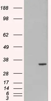 WB analysis of HEK293 overexpressing ORC6 (mock transfection in first lane) using GTX89996 ORC6 antibody, C-term. WB analysis of HEK293 overexpressing ORC6 (mock transfection in first lane) using GTX89996 ORC6 antibody, C-term.