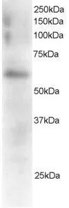 WB analysis of mouse spleen extracts using GTX95551 FGR antibody,C-term. Dilution : 0.5ug/ml Loading : 35ug protein in RIPA buffer