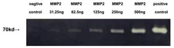 Mouse MMP2 protein, His tag (active). GTX00073-pro