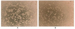 Human Interferon gamma protein, His tag (active). GTX00083-pro