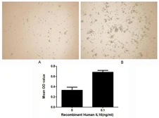 Human IL16 protein, His tag (active). GTX00089-pro