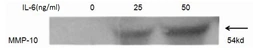 Human IL6 protein, His and GST tag (active). GTX00094-pro