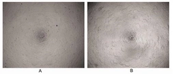 Human IL6 protein, His tag (active). GTX00095-pro