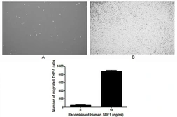 Human SDF1 protein, His tag (active). GTX00098-pro