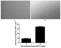 Human SDF1 protein, His and GST tag (active). GTX00099-pro