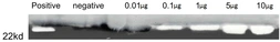 Human MMP13 protein, His tag (active). GTX00191-pro