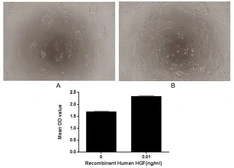 Human HGF protein, His tag (active). GTX00206-pro