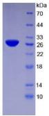 Human TFPI2 protein, His tag (active). GTX00278-pro