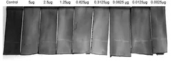 Human TFPI2 protein, His tag (active). GTX00278-pro