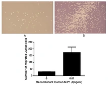 Human MIP1 beta protein, His tag (active). GTX00279-pro