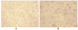 Rat Galectin 3 protein, His tag (active). GTX00361-pro