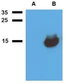 Anti-Mycobacterium tuberculosis Acr1 antibody [PAb (185)] used in Western Blot (WB). GTX00500