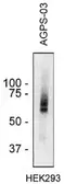 Anti-Alkyl-DHAP synthase antibody [AGPS-03] used in Western Blot (WB). GTX00518