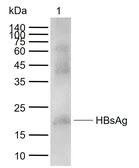 Anti-Hepatitis B virus Surface Antigen antibody used in Western Blot (WB). GTX00629
