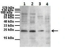 Anti-PTHLH antibody used in Western Blot (WB). GTX00631