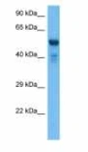Anti-UGT2B17 antibody used in Western Blot (WB). GTX00639