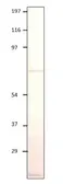 Anti-IL17 Receptor beta antibody used in Western Blot (WB). GTX00640