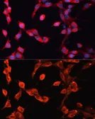 Anti-ADAMTS13 antibody used in Immunocytochemistry/ Immunofluorescence (ICC/IF). GTX00642