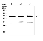 Anti-HtrA1 antibody used in Western Blot (WB). GTX00643