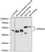 Anti-alpha 2b Adrenergic Receptor antibody used in Western Blot (WB). GTX00651