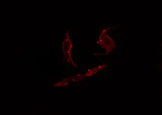 Anti-PARD3 antibody used in Immunocytochemistry/ Immunofluorescence (ICC/IF). GTX00653