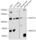 Anti-AMOTL2 antibody used in Western Blot (WB). GTX00661